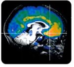 Trabajo Fin de Grado en Veterinaria - La serotonina y la agresividad en perros. Serotonin and aggressiveness in dogs - Universidad de Zaragoza