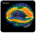 Trabajo Fin de Grado en Veterinaria - La serotonina y la agresividad en perros. Serotonin and aggressiveness in dogs - Universidad de Zaragoza