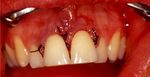 Arte y ciencia en el diagnóstico de la enfer-medad periodontal atípica: reporte de caso - SciELO España