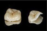2ª Edición del curso modular de endodoncia y reconstrucción del diente endodonciado 2019