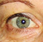 EASY EYE SOLUTIONS Instant Eye Tuck & Dark Circle Treatment Illuminating Eye Care UnderCover Active Highlighter