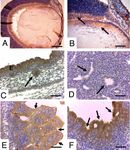 Inmunolocalizaci&oacute;n de Sonic Hedgehog en el Desarrollo Embrio-Fetal de Ratones (Mus musculus) - SciELO