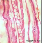 Modelo experimental de queratosis act&iacute;nica por exposici&oacute;n a radiaci&oacute;n ultravioleta A