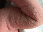 GU&Iacute;AS DIAGN&Oacute;STICAS Y TERAP&Eacute;UTICAS DE LAS 10 PATOLOG&Iacute;AS M&Aacute;S FRECUENTES - HOSPITAL INFANTIL DE M&Eacute;XICO "FEDERICO G&Oacute;MEZ" SERVICIO DE DERMATOLOG&Iacute;A - himfg