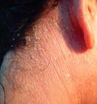 GU&Iacute;AS DIAGN&Oacute;STICAS Y TERAP&Eacute;UTICAS DE LAS 10 PATOLOG&Iacute;AS M&Aacute;S FRECUENTES - HOSPITAL INFANTIL DE M&Eacute;XICO "FEDERICO G&Oacute;MEZ" SERVICIO DE DERMATOLOG&Iacute;A - himfg