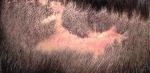 LA ALOPECIA Y SUS POSIBLES TRATAMIENTOS - www.imdermatologico.com