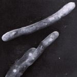 Tuberculosis en M&eacute;xico - Est&aacute;ndares para la Atenci&oacute;n de la