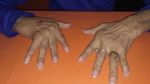 Artritis Reumatoidea Monograf&iacute;a sobre - Centro de Estudios Osteop&aacute;ticos de Buenos Aires - Centro de estudios ...