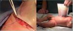DEFECTOS DE ABDOMINAL EN RECIEN NACIDOS - PARED Dra. Sandra Toledo Becada de Pediatria