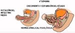 DEFECTOS DE ABDOMINAL EN RECIEN NACIDOS - PARED Dra. Sandra Toledo Becada de Pediatria