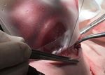 DEFECTOS DE ABDOMINAL EN RECIEN NACIDOS - PARED Dra. Sandra Toledo Becada de Pediatria