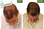 PORTAFOLIO CAPIHERBAL - @capiherbal 3192526853 @capi.herbal - ConnectAmericas