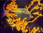 GENERALIDADES VIRUS SARS COV2 - JEANNETTE DABANCH PE&Ntilde;A INTERNISTA INFECTOLOGA HOSPITAL CLINICO U DE CHILE PROGRAMA DE ENFERMEDADES INFECCIOSAS DEL ...